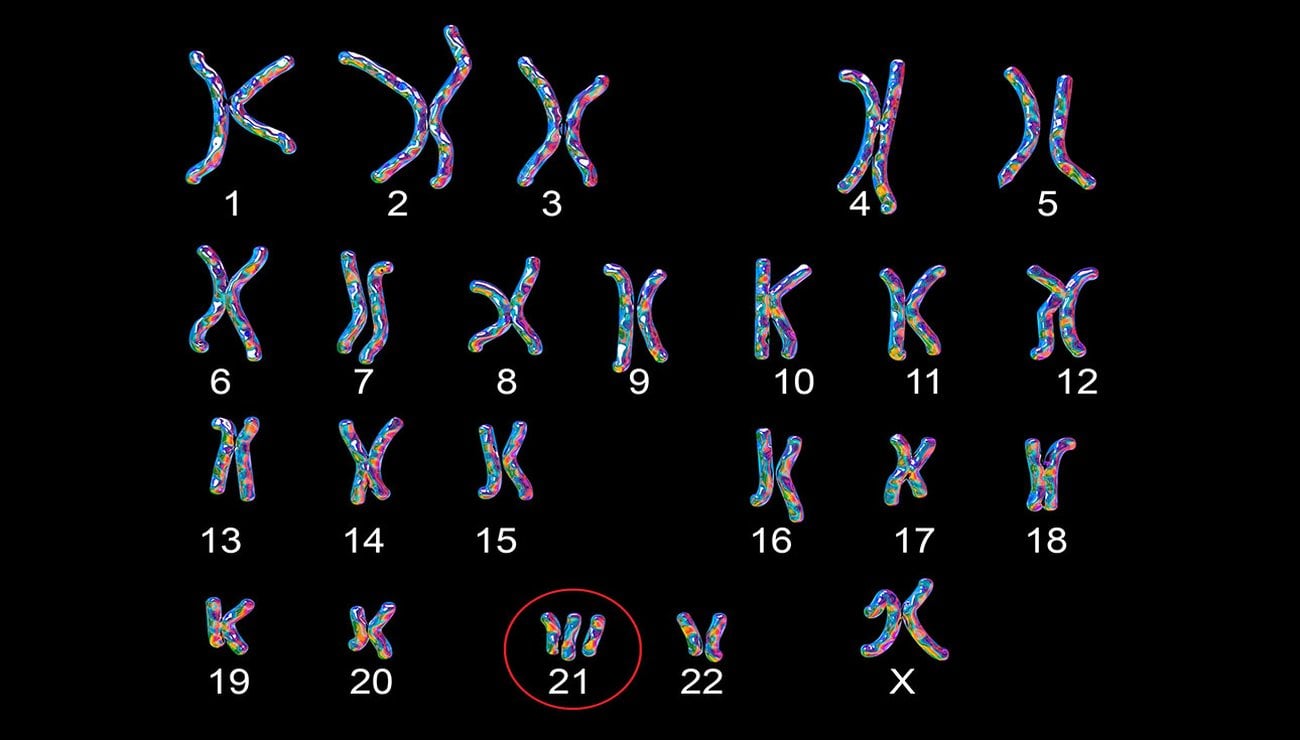Le chromosome 21