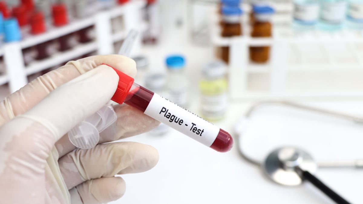 Un flacon d'un test à la peste