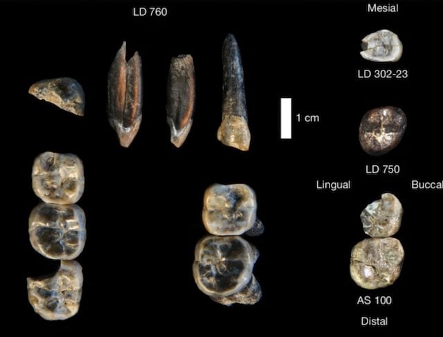 Photos montrant les dents découvertes