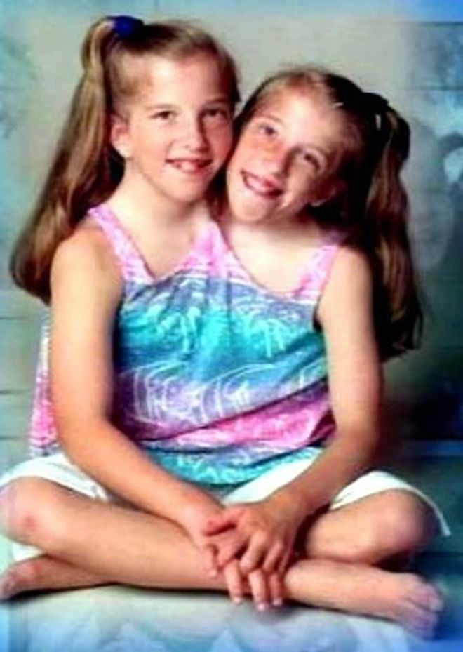 Abby et Brittany Hensel
