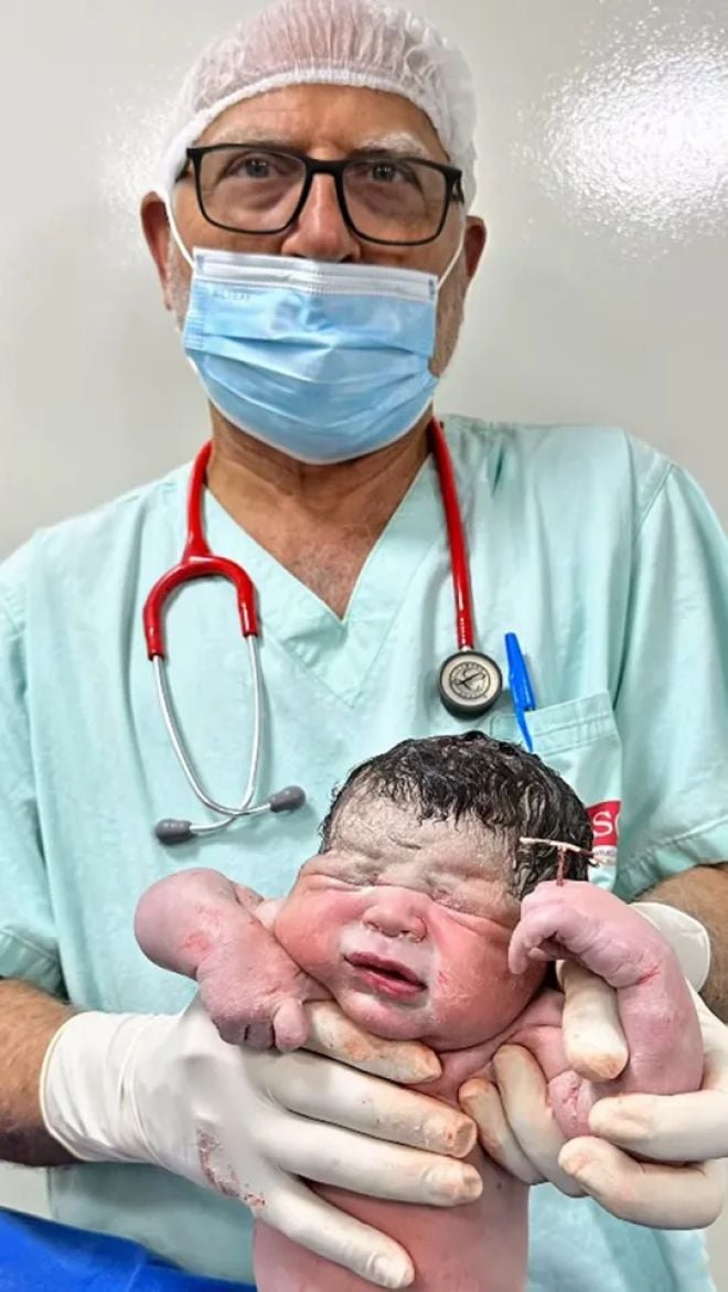 Un médecin tient le bébé avec le stérilet dans la main