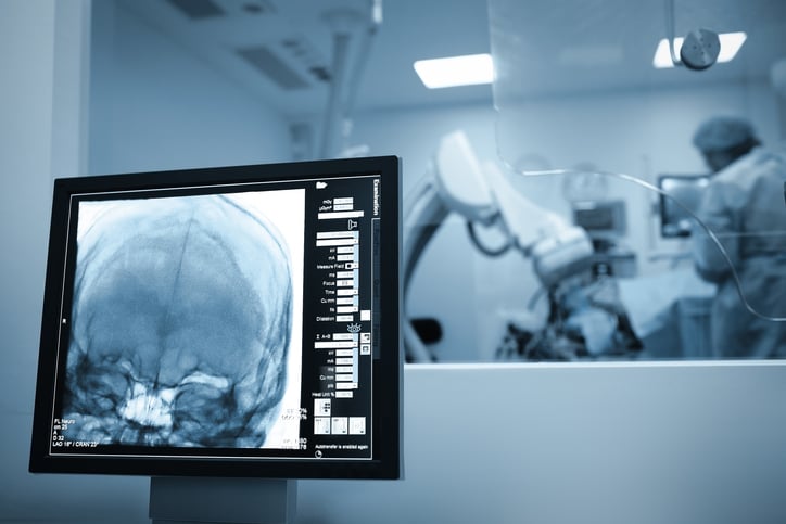 Un cerveau pendant une chirurgie