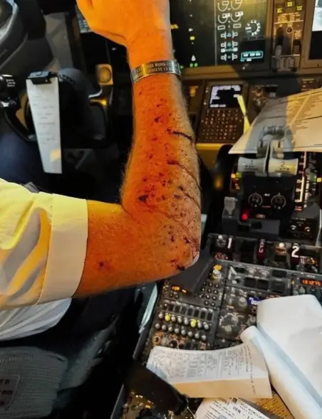 Un pilote d'avion, blessé au bras