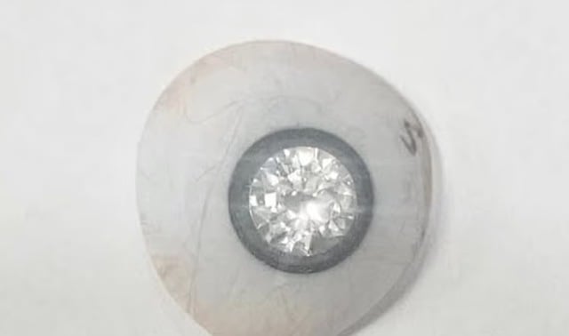 Prothèse oculaire en forme de diamant