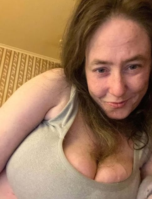 Jayne Stephen avant son amputation 