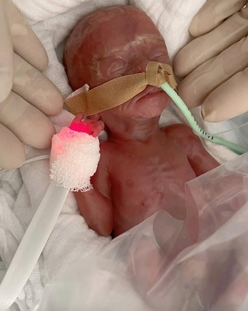 La petite fille le jour de sa naissance 