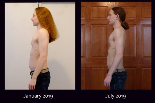 Un avant apr&egrave;s de James Stewart Whyte