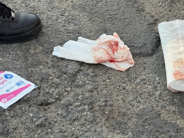 Des compresses imbib&eacute;es de sang apr&egrave;s l'accident 
