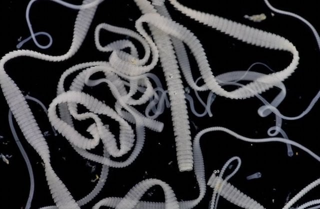 Image montrant des parasites