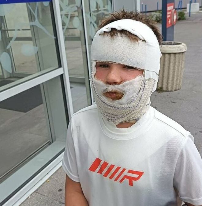 Les bandages de Melvyn