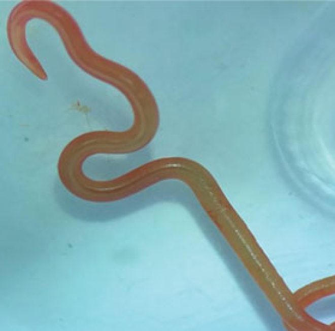 Le parasite