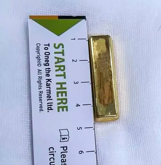 Le lingot d'or retrouv&eacute; dans l'estomac de la petite fille