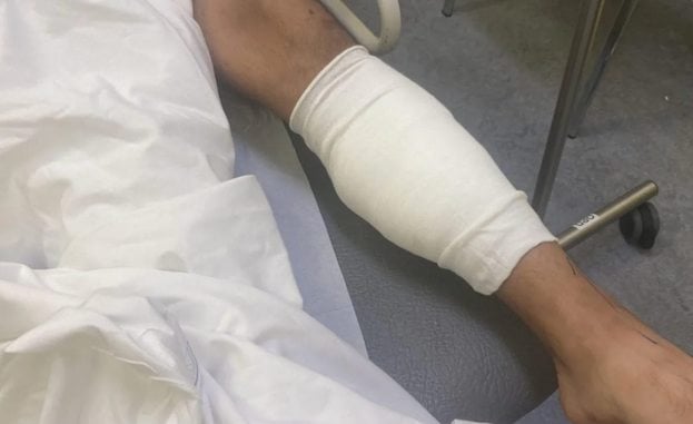 La blessure de Sabastian Achim