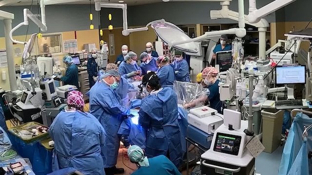 L'op&eacute;ration visant &agrave; s&eacute;parer les jumelles 