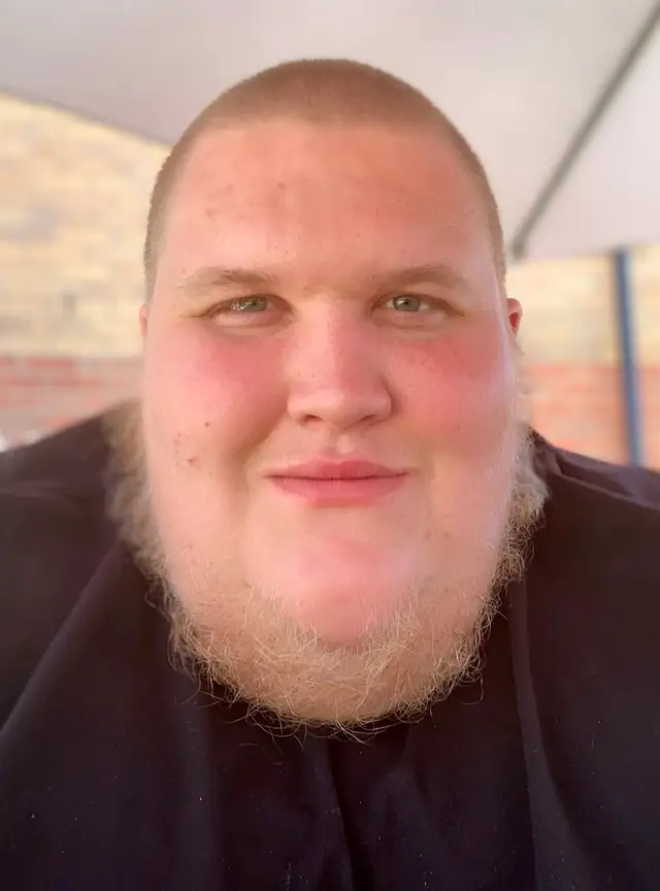 Jack Acko avant sa perte de poids