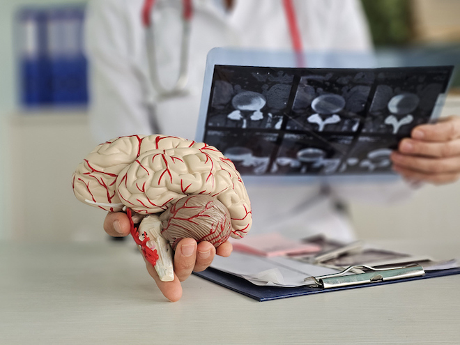 Un m&eacute;decin face &agrave; la maladie d'Alzheimer