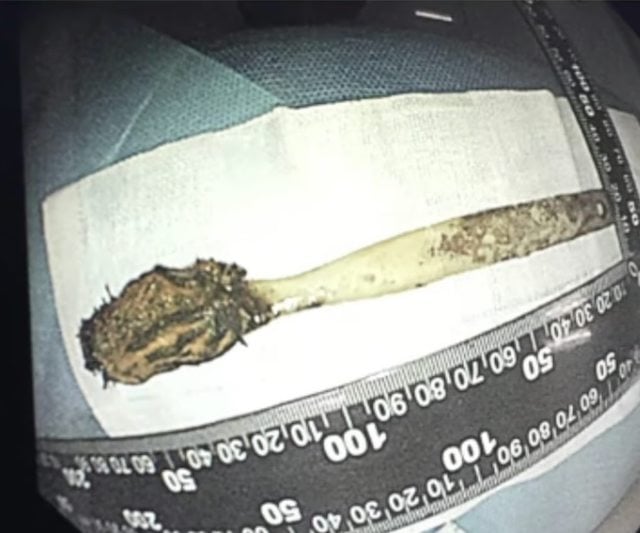 La brosse &agrave; dents retrouv&eacute;e