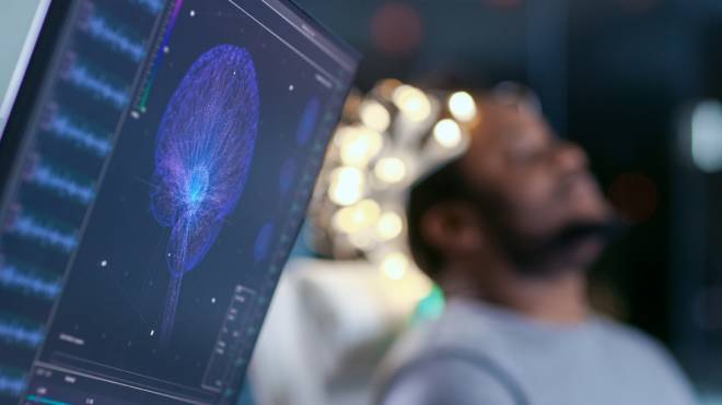 Moniteur montrant un mod&egrave;le graphique du cerveau &agrave; c&ocirc;t&eacute; d'un patient