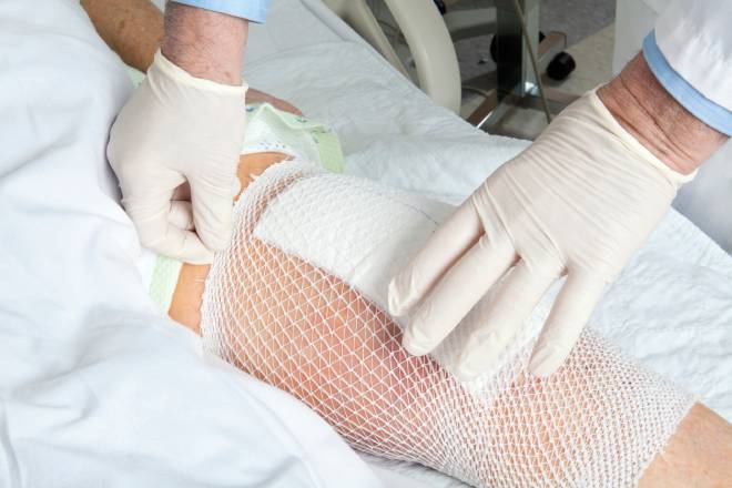 M&eacute;decin posant un bandage sur un genou