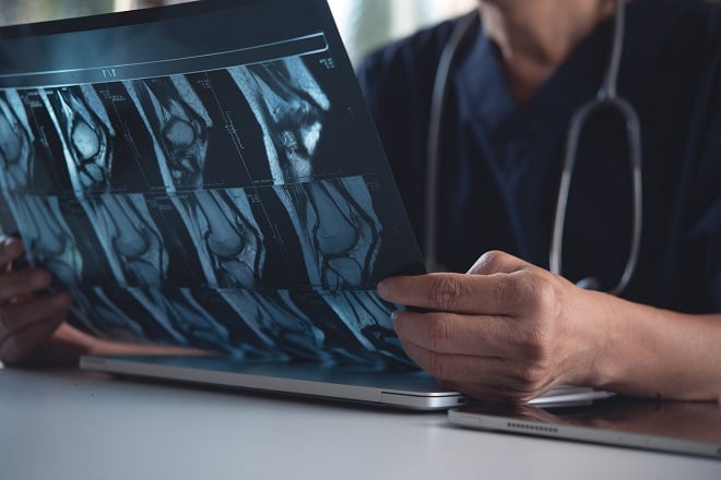 Médecin regardant les radios d'un patient