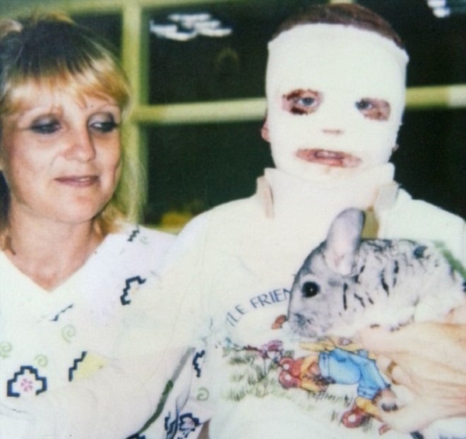 Terry McCarthy recouvert de bandage sur le visage